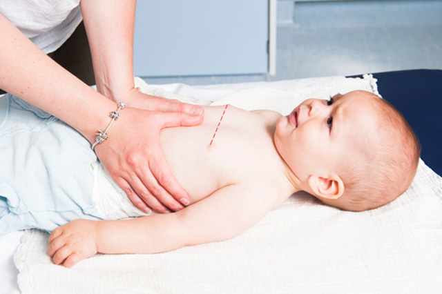 massage cardiaque chez le bébé